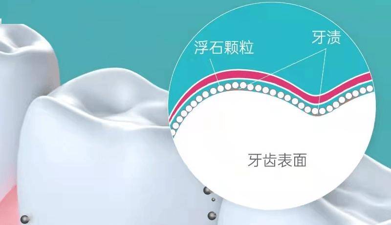 【章小蕙推荐】牙黄怎么办？瑞士怀尔德牙膏告诉你安全不伤牙的白牙方法